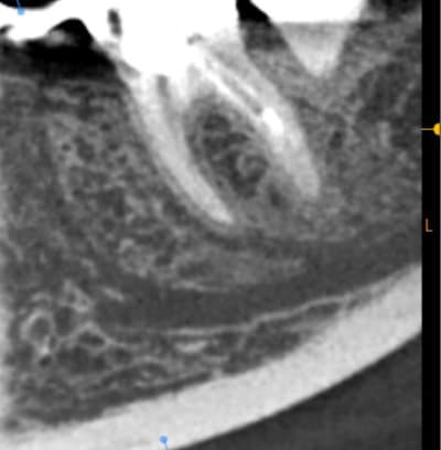 Image1 hnklvl - Eugenol