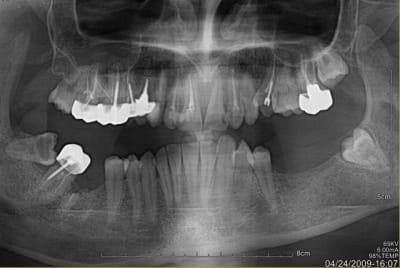 Image1 imufcn - Eugenol