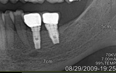 Image1 juplas - Eugenol