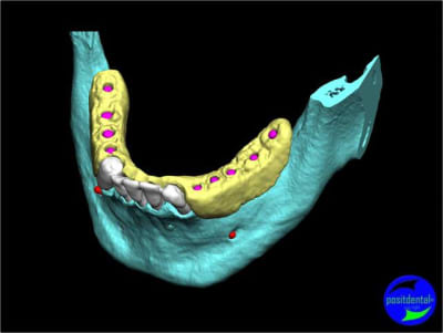 Image1 kfaqkj - Eugenol