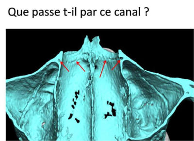 Image1 ktaljk - Eugenol