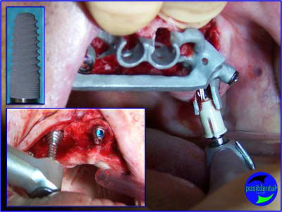 Image1 pky5du - Eugenol