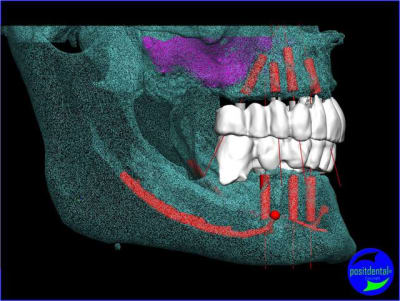 Image1 rxh4so - Eugenol