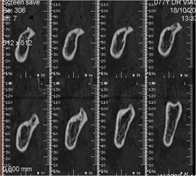 Image1 sx54ur - Eugenol