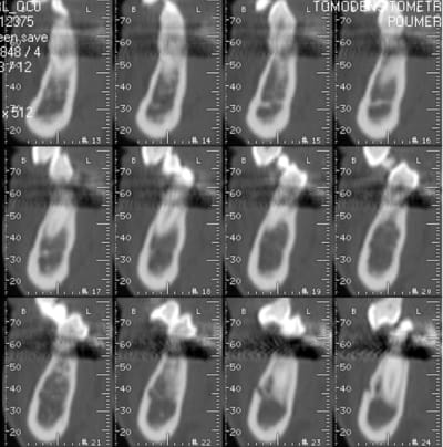 Image1 wdizhp - Eugenol