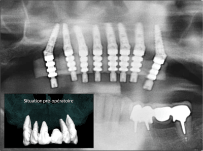 Image1 wwnxqh - Eugenol