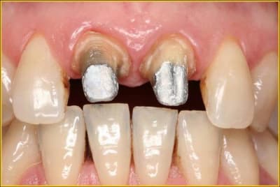 Image1 yze7hz - Eugenol