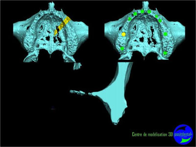 Image22 sgpdx3 - Eugenol