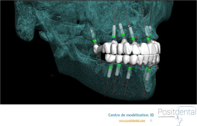 Image2 begxlt - Eugenol