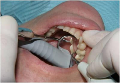 Image2 feqpru - Eugenol