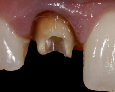 Image2 mlckl9 - Eugenol