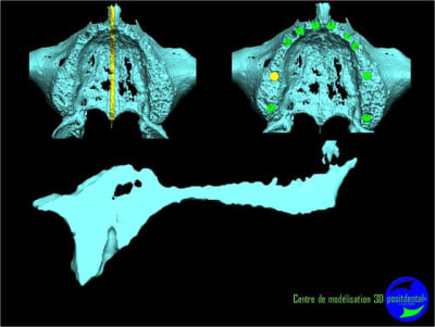 Image2 nc2tin - Eugenol