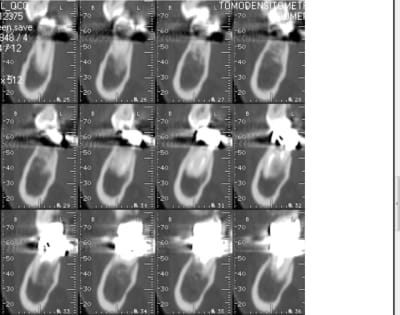 Image2 o04su7 - Eugenol