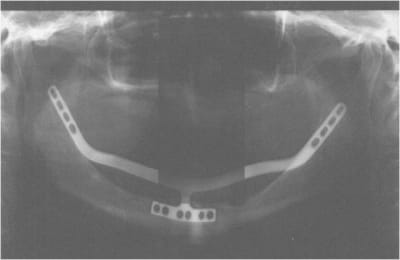 Image2 ok8ysy - Eugenol