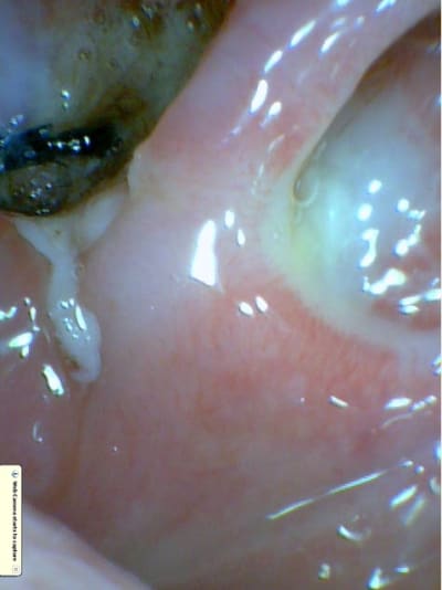 Image2 rjsk6s - Eugenol