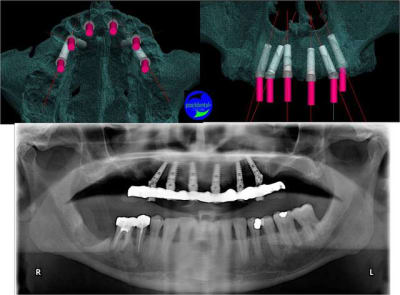 Image2 xlmqet - Eugenol