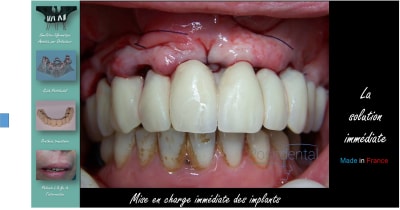 Image30 frslqz - Eugenol