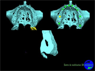Image31 kqstrg - Eugenol