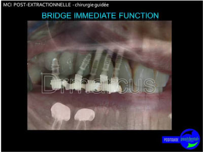 Image32 pfuhhg - Eugenol