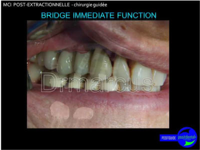 Image33 ixe7fm - Eugenol