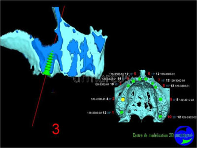Image39 zv5dgg - Eugenol