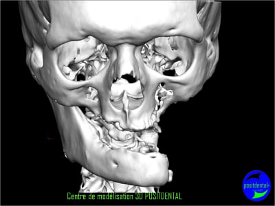 Image3 beefxb - Eugenol