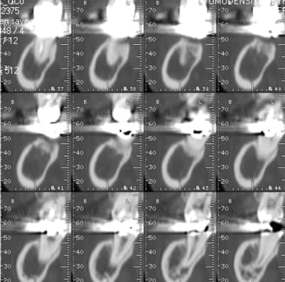 Image3 j69tuy - Eugenol