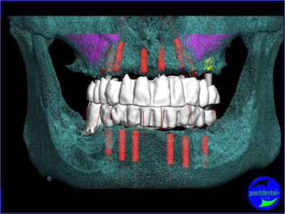 Image3 ku8gvq - Eugenol