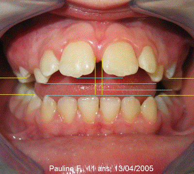 Image3 notzpv - Eugenol