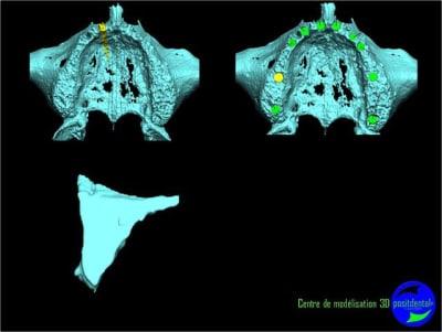 Image4 h4pvo9 - Eugenol