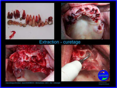 Image4 kjvngi - Eugenol