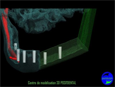 Image4 ndsht4 - Eugenol