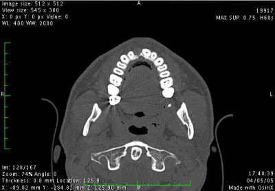 Image5 frcyrd - Eugenol