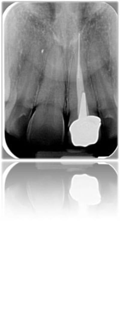 Image5 skcbcz - Eugenol