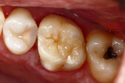 Image7 dh3gsy - Eugenol