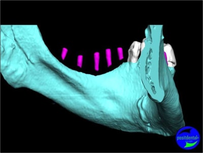 Image7 y834pb - Eugenol