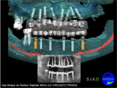 Image9 dda06a - Eugenol