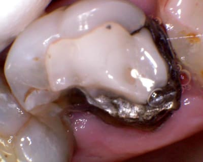 Image 064 ulaoug - Eugenol