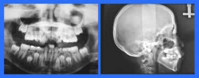 Image 1 wasfvq - Eugenol