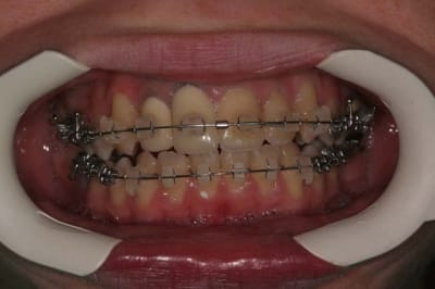 Image 3 xdhlmk - Eugenol