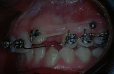 Img 1981 jshylk - Eugenol