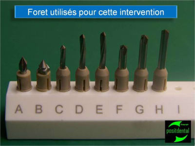 Implant angul  positdental 15 eehgfw - Eugenol