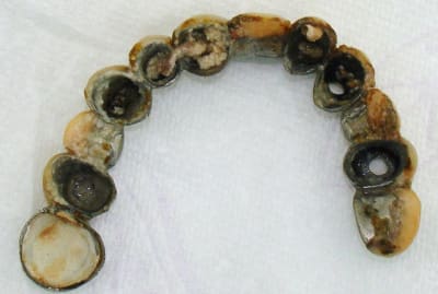 Intrado bridge descelle n1equb - Eugenol