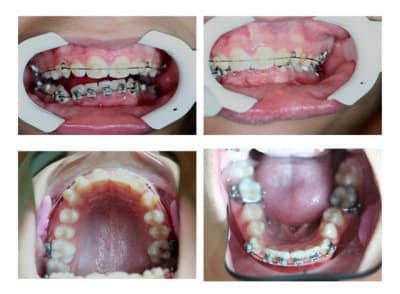 Inv. art. g - Eugenol