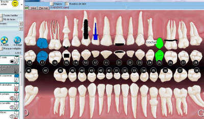 Julie dent absente2 asysnv - Eugenol