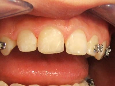 Julien après vk7kdq - Eugenol