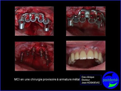 K4 puquvc - Eugenol