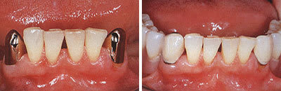 Konus bofepq - Eugenol