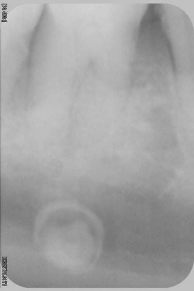 Keks ksa txmhmh - Eugenol