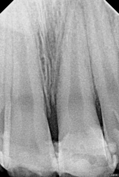 Leo2 rhlmqb - Eugenol